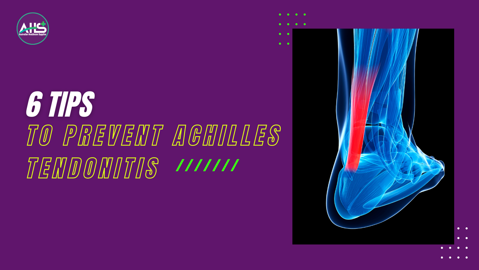 tips to prevent achilles tendonitis